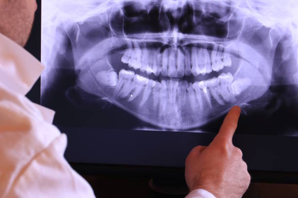 Best Emergency Treatment for Oral Infections in Dover, DE
