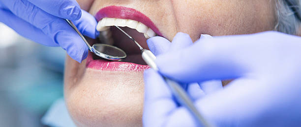 Best Emergency Root Canal Therapy in Dover, DE